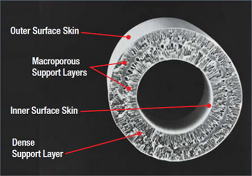 從全球市(shì)場看(kàn)中空(kōng)纖維分(fēn)離膜在水(shuǐ)處理(lǐ)領域的(de)最新進展 從全球市(shì)場看(kàn)中空(kōng)纖維分(fēn)離膜在水(shuǐ)處理(lǐ)領域的(de)最新進展